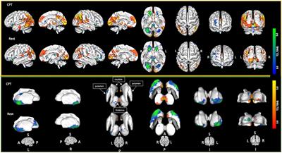 Adverse childhood experiences, brain function, and psychiatric diagnoses in a large adult clinical cohort